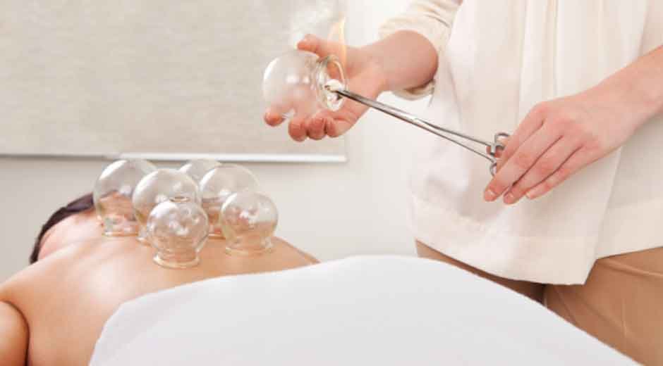 What is Cupping Therapy? Is It Relevant Today