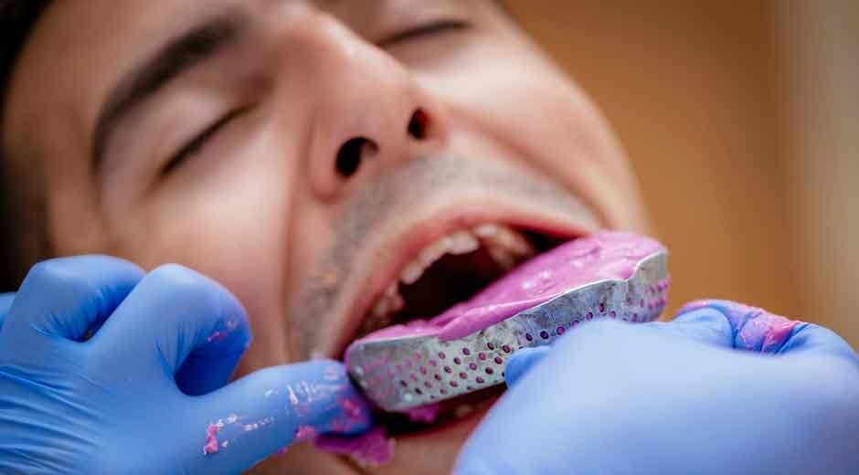 Steps Involved in Creating Custom Dental Appliances