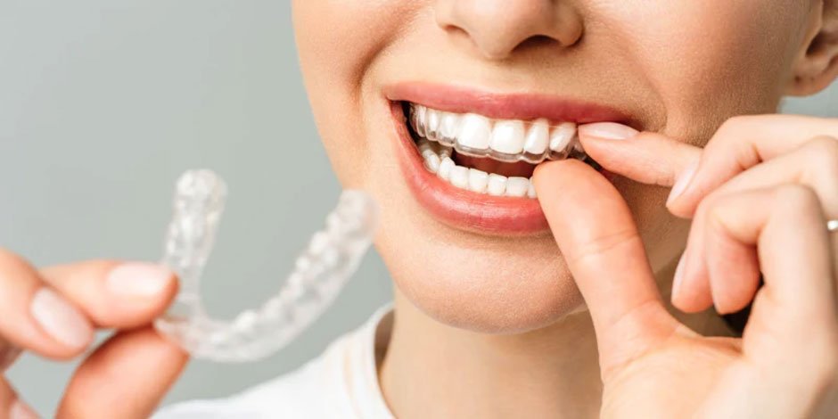 Why More Adults Are Choosing to Straighten Their Teeth Now Than Ever Before