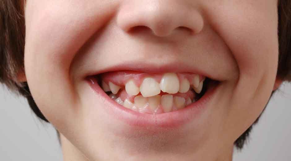Signs Your Child Needs to See an Orthodontist in Las Vegas