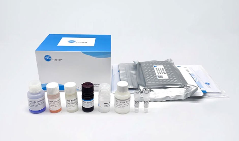 How ELISA Kits Help Scientists Detect Proteins, Antibodies, And Antigens Accurately