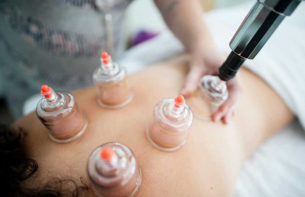 Cupping Therapy in Brooklyn