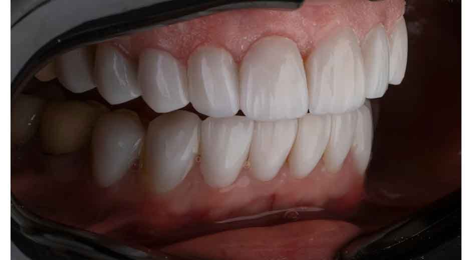 Guide to Fixing Your Smile and Boosting Your Confidence