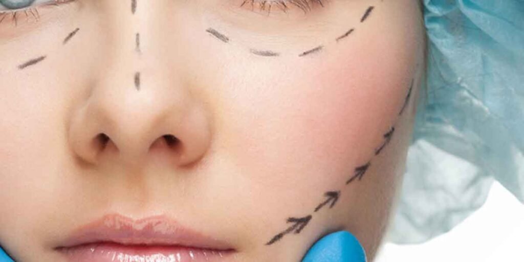 FAQs About the Safety of Plastic Surgery